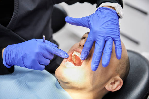 Best Emergency Treatment for Dental Infections or Abscesses in Springfield, MI