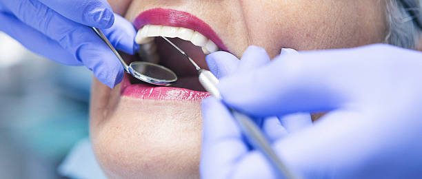 Best Emergency Gum Treatment in Springfield, MI